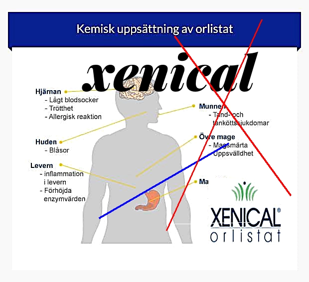 Vente de xenical en france